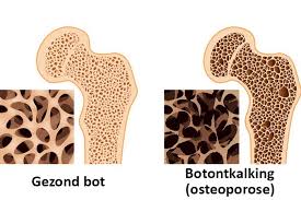 botdichtheid verbeteren