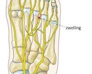 zenuwen voet anatomie