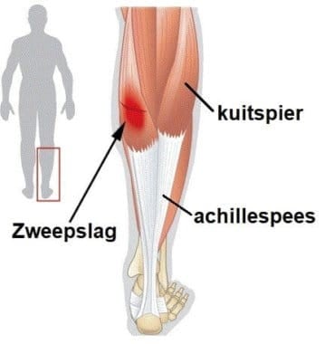 anatomie onderbeen spieren