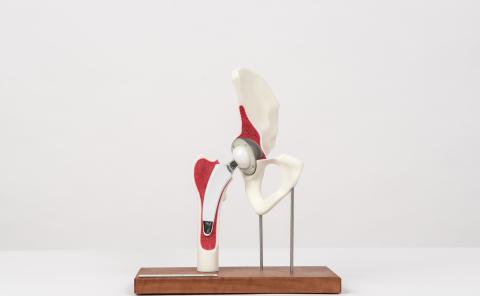 orthopedie az jan portaels