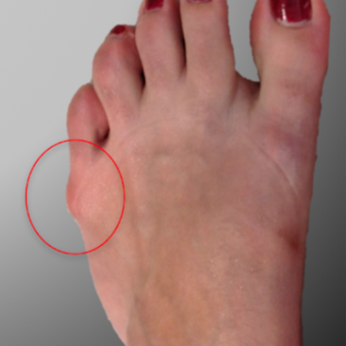 orthopedie specialisatie voeten