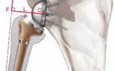 orthopedie schouder specialist