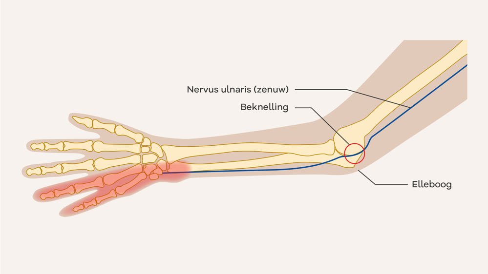 anatomie zenuwen hand
