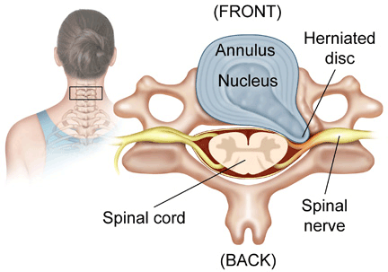 cervicale wervelkolom anatomie