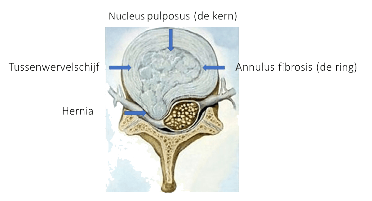 lage rug anatomie