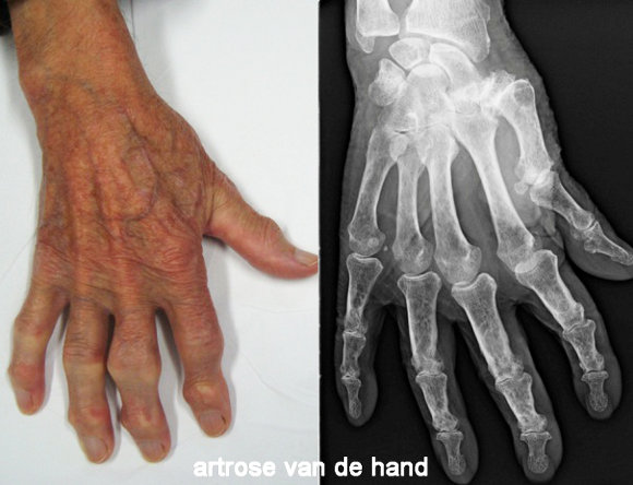 wat betekent orthopedie